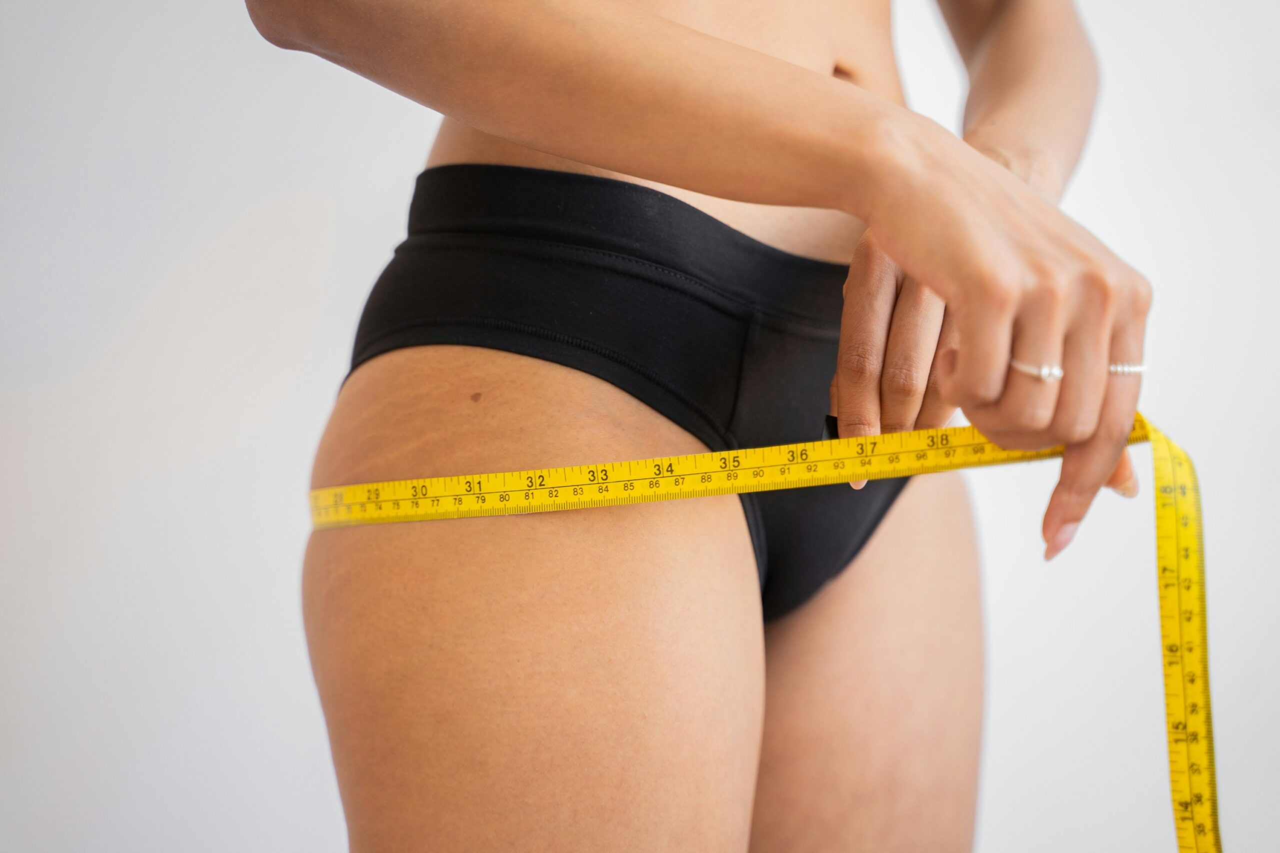 Before and after photos highlighting visible weight loss transformation